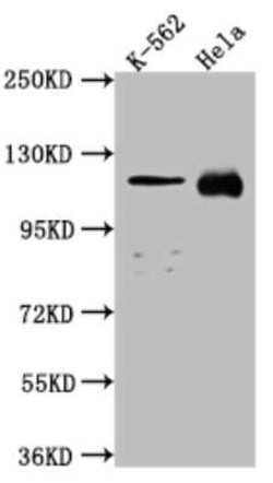 NUP98 Antibody (2H4), Novus Biologicals 100 &mu;g | Buy Online | Novus Biologicals | Fisher Scientific