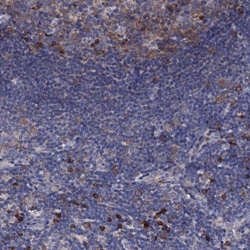 NUPL1 Antibody, Novus Biologicals:Antibodies:Primary Antibodies