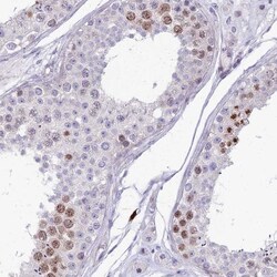 NUSAP1 Antibody, Novus Biologicals 0.1mL; Unlabeled:Antibodies, Polyclonal