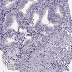 NUT Antibody, Novus Biologicals 0.1mL; Unlabeled:Antibodies, Polyclonal