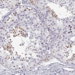 NUT Antibody, Novus Biologicals 0.1mL; Unlabeled:Antibodies, Polyclonal