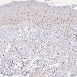 NVL Antibody, Novus Biologicals 0.1mL; Unlabeled:Antibodies, Polyclonal