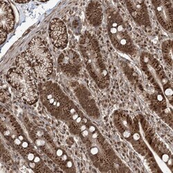 NY-REN-50 antigen Antibody, Novus Biologicals 0.1mL; Unlabeled:Antibodies,