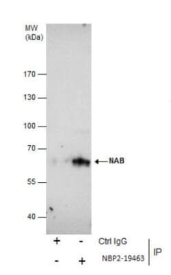 Nab2 Antibody, Novus Biologicals 0.1mL; Unlabeled:Antibodies, Polyclonal