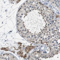 Nanos2 Antibody, Novus Biologicals 25 &mu;L, Unlabeled:Antibodies, Polyclonal