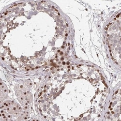 Nanos3 Antibody, Novus Biologicals 0.1mL; Unlabeled:Antibodies, Polyclonal