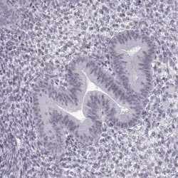 Nanos3 Antibody, Novus Biologicals 0.1mL; Unlabeled:Antibodies, Polyclonal