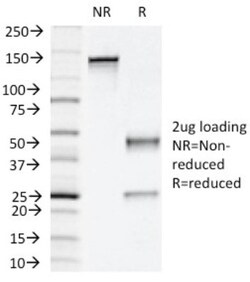 Napsin A Antibody (NAPSA/1239), Novus Biologicals 0.2mg; Unlabeled:Antibodies,