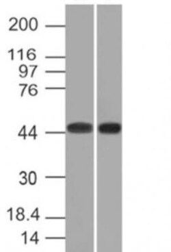 Napsin A Antibody (NAPSA/1239), Novus Biologicals 0.2mg; Unlabeled:Antibodies,