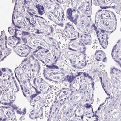 Napsin A Antibody, Novus Biologicals 0.1mL; Unlabeled:Antibodies, Polyclonal
