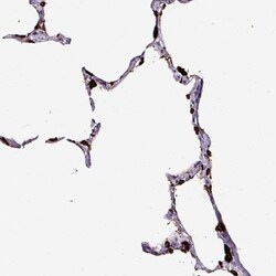 Napsin A Antibody, Novus Biologicals 0.1mL; Unlabeled:Antibodies, Polyclonal