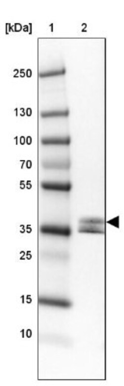 Napsin A Antibody, Novus Biologicals 0.1mL; Unlabeled:Antibodies, Polyclonal