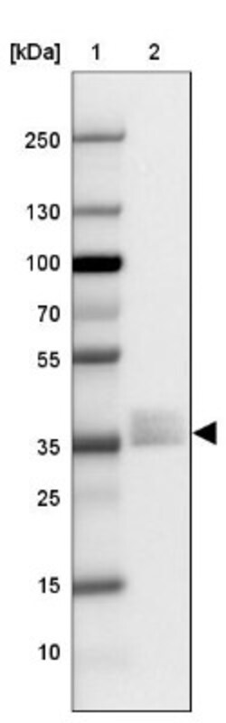 Napsin A Antibody, Novus Biologicals 0.1mL; Unlabeled:Antibodies, Polyclonal
