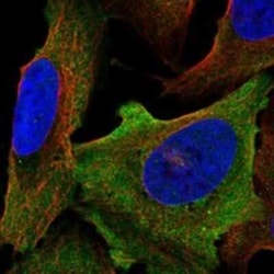 Nav1.6 Rabbit anti-Human, Polyclonal, Novus Biologicals 25 &mu;g | Buy Online | Novus Biologicals | Fisher Scientific