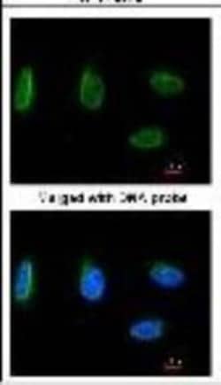 Nbs1 Antibody (1D7), Novus Biologicals 0.1mL; Unlabeled:Antibodies, Monoclonal