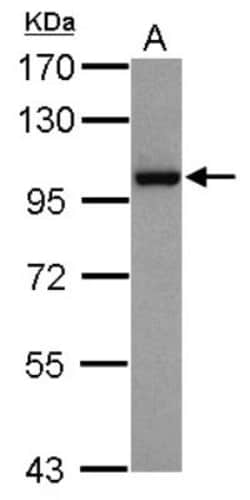 Nbs1 Antibody (1D7), Novus Biologicals 0.1mL; Unlabeled:Antibodies, Monoclonal