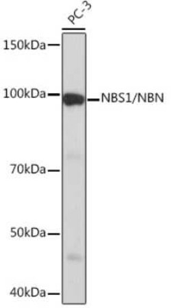 Nbs1 Rabbit anti-Human, Clone: 4G4R1, Novus Biologicals 100 &mu;g | Buy Online | Novus Biologicals | Fisher Scientific