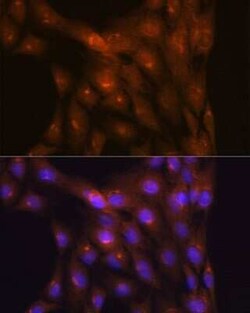 Ndufs4 Rabbit anti-Human, Mouse, Rat, Clone: 6T10F4, Novus Biologicals