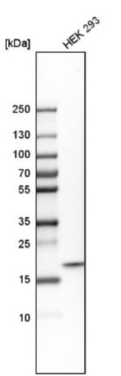 Ndufs4 Antibody, Novus Biologicals 25 &mu;L; Unlabeled:Antibodies, Polyclonal