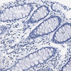 Nebulin Antibody, Novus Biologicals:Antibodies:Primary Antibodies