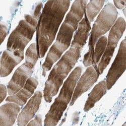 Nebulin Antibody, Novus Biologicals:Antibodies:Primary Antibodies