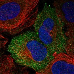 Nectin-4/PVRL4 Antibody, Novus Biologicals 25 &mu;L; Unlabeled:Antibodies,