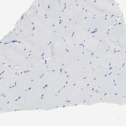Nectin-4/PVRL4 Antibody, Novus Biologicals 25 &mu;L; Unlabeled:Antibodies,
