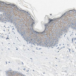 Nectin-4/PVRL4 Antibody, Novus Biologicals 25 &mu;L; Unlabeled:Antibodies,