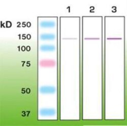 Nephrin Antibody (Y17-R), Novus Biologicals 0.05mL; Unlabeled:Antibodies,