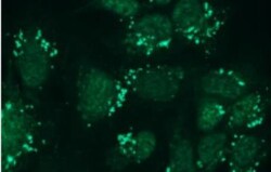 Nephrin Antibody (Y17-R), Novus Biologicals 0.05mL; Unlabeled:Antibodies,
