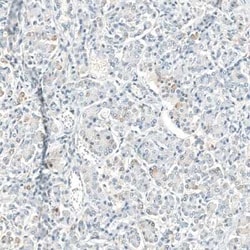 Neprilysin/CD10 Mouse anti-Human, Clone: CL12448, Novus Biologicals 25 &mu;g | Buy Online | Novus Biologicals | Fisher Scientific