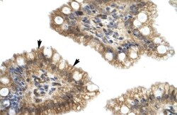 Nesfatin-1/Nucleobindin-2 Antibody, Novus Biologicals 0.1mg; Unlabeled:Antibodies,
