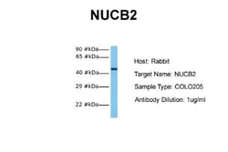 Nesfatin-1/Nucleobindin-2 Antibody, Novus Biologicals 0.1mg; Unlabeled:Antibodies,
