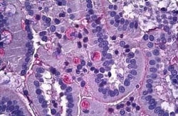 Netrin-1 Antibody, Novus Biologicals 0.1mg; Unlabeled:Antibodies, Polyclonal