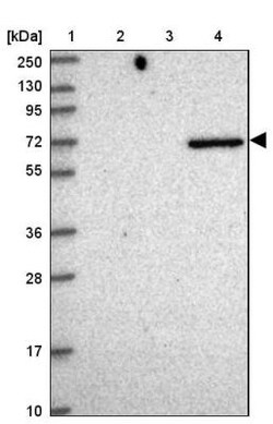 Netrin-2 Antibody, Novus Biologicals:Antibodies:Primary Antibodies