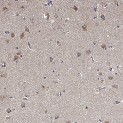 Neudesin Antibody, Novus Biologicals:Antibodies:Primary Antibodies