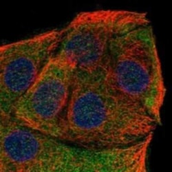 Neuferricin Rabbit anti-Human, Polyclonal, Novus Biologicals 25 &mu;g | Buy Online | Novus Biologicals | Fisher Scientific