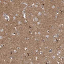 Neurabin 1 Antibody, Novus Biologicals 0.1mL; Unlabeled:Antibodies, Polyclonal