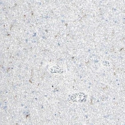 Neuregulin-1/NRG1 Antibody, Novus Biologicals 25 &mu;L; Unlabeled:Antibodies,