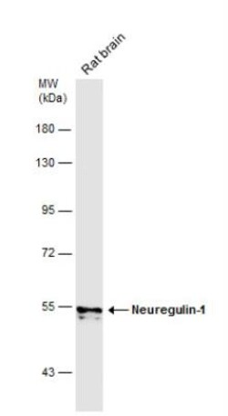 Neuregulin-1/NRG1 Antibody, Novus Biologicals 0.1mL; Unlabeled:Antibodies,