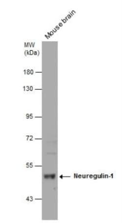 Neuregulin-1/NRG1 Antibody, Novus Biologicals 0.1mL; Unlabeled:Antistoffer