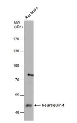 Neuregulin-1/NRG1 Antibody, Novus Biologicals 0.1mL; Unlabeled:Antistoffer