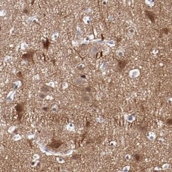Neurexin 3/NRXN3 Antibody, Novus Biologicals:Antibodies:Primary Antibodies