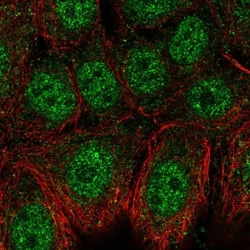 Neuro D4 Antibody, Novus Biologicals 0.1mL; Unlabeled:Antibodies, Polyclonal