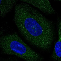Neurochondrin Antibody, Novus Biologicals 0.1mL; Unlabeled:Antibodies,