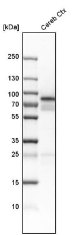 Neurochondrin Antibody, Novus Biologicals 0.1mL; Unlabeled:Antibodies,