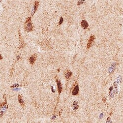 Neurofibromin 1 Antibody (McNFn27a) - BSA Free, Novus Biologicals 0.05mL;