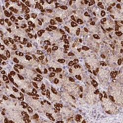 Neurofibromin 1 Antibody, Novus Biologicals 25 &mu;L, Unlabeled:Antibodies,