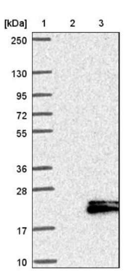 Neurokinin B Antibody, Novus Biologicals 25 &mu;L | Buy Online | Novus Biologicals | Fisher Scientific