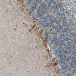 Neuroligin 3/NLGN3 Antibody, Novus Biologicals 25 &mu;L; Unlabeled:Antibodies,